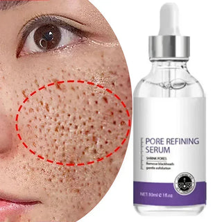 Retinol & Niacinamide Serum – Pore Refining & Skin Texture Booster | WDBY Beauty