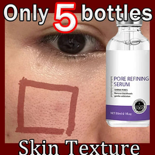 Retinol & Niacinamide Serum – Pore Refining & Skin Texture Booster | WDBY Beauty