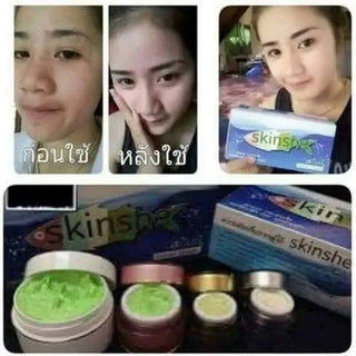 SKINSHE Whiten Gift set Reduce Wrinkles Freckles Dark Spots Brighten White Moisturizer Skin Smooth And Clear For Men Women